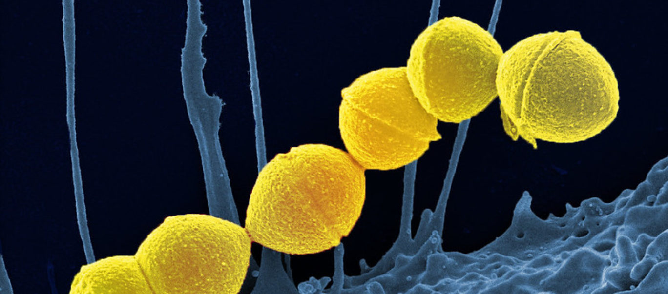 Group A Strep bacteria