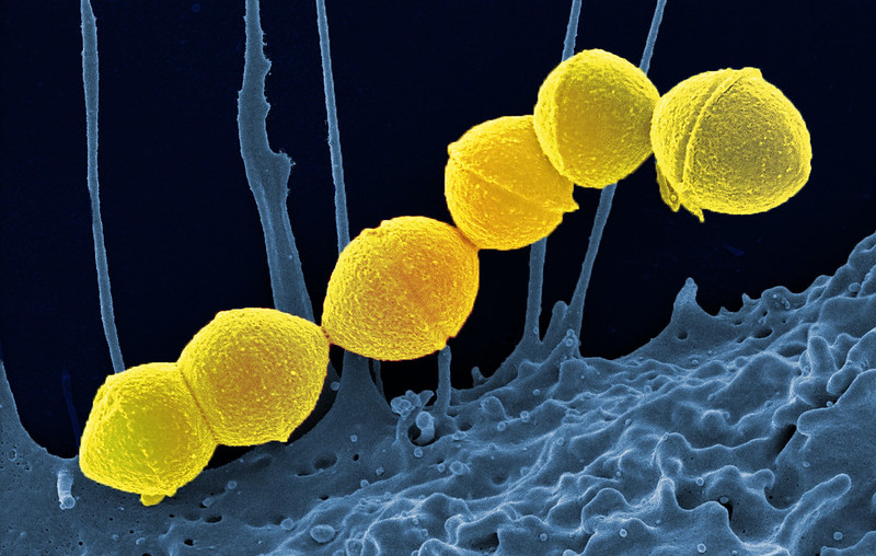 Group A Strep bacteria